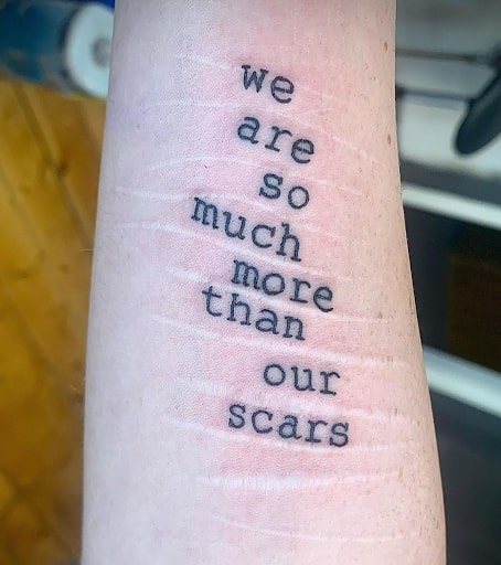 We are so much more than our scars